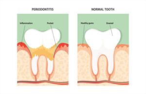 As long as you have a healthy mouth, you do not consider the condition ...